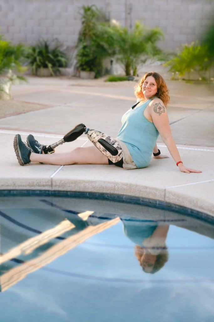Woman with an above-knee prosthetic leg sitting beside a swimming pool, enjoying an active and confident lifestyle.