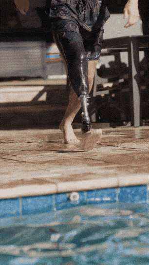 Activity-specific prosthetic leg