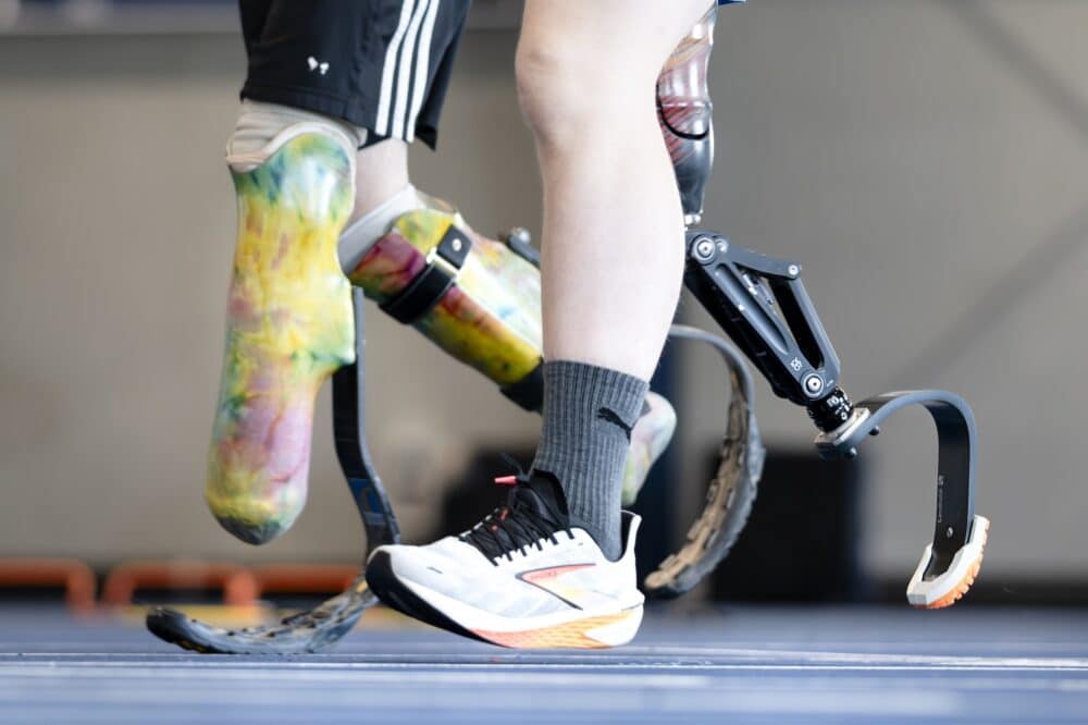 Sports & Specialty Prosthetics