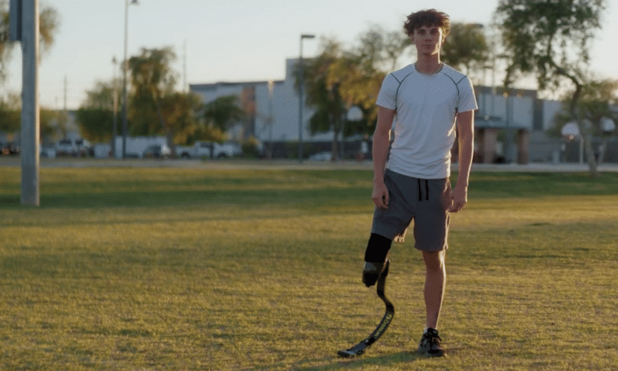 Young man with prosthetic leg standing in a park during sunset