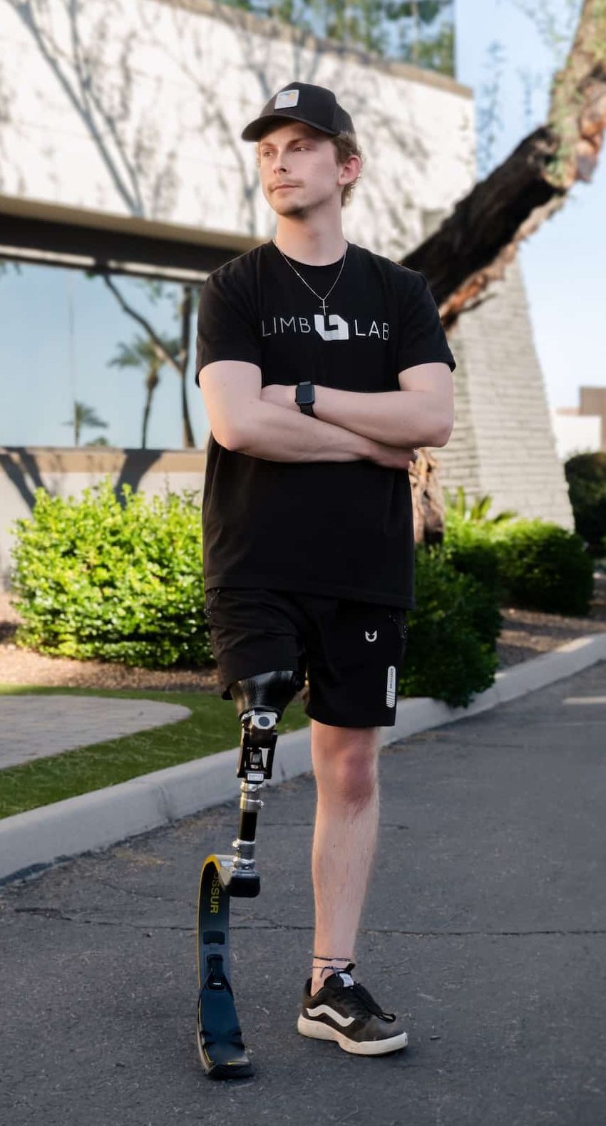 Limb Lab client with a transfemoral prosthesis