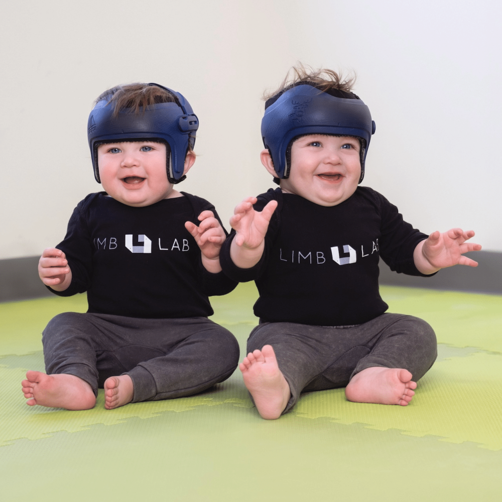 Twin babies wearing their matching cranial helmet orthoses.