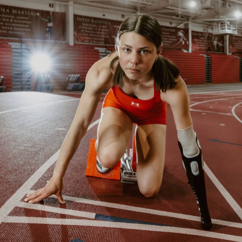 Petra posing with her upper limb prosthesis
