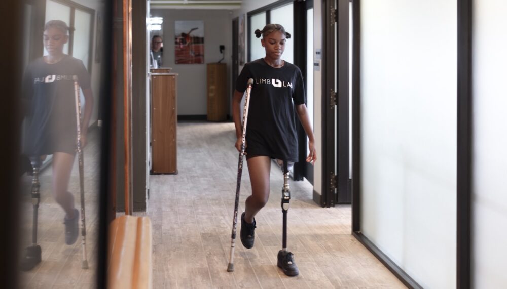 Pediatric Prosthetics